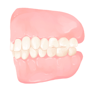 정상교합(normal occlusion)’이란